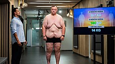 Tomá� Mu�ka za rok shodil neuv��itelných 102 kilogram�. Kv�li tomu te� ale má...