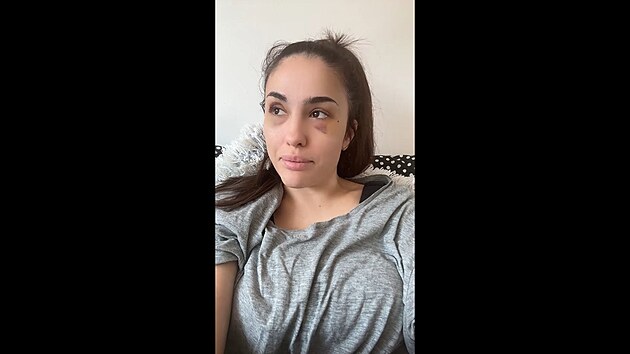 Christine z Bachelora ukzala pomlcen obliej, ml ji zmltit partner.