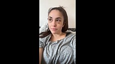 Christine z Bachelora ukázala pomlácený obliej, ml ji zmlátit partner.