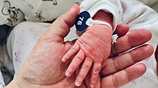 Hana T�e�tíková sdílela první fotku dcery