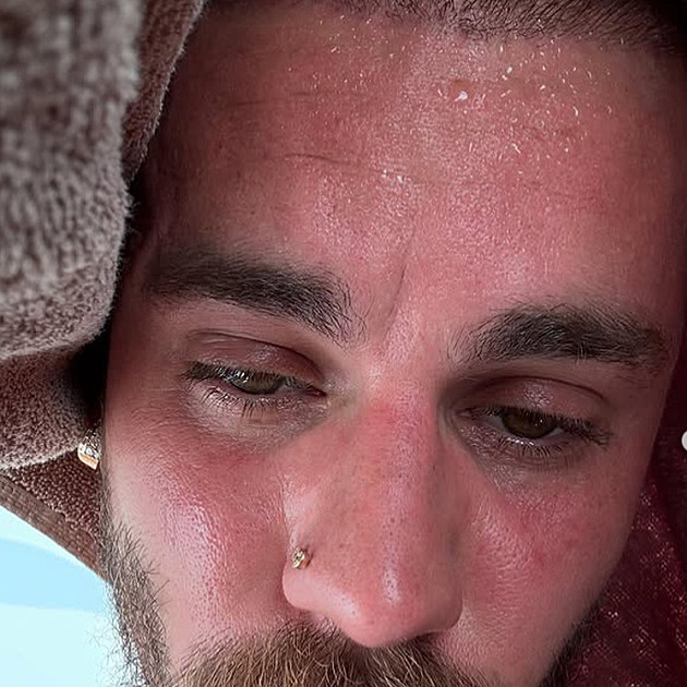 Detox Justina Biebera? Zpvák na sítích opt znepokojil své fanouky
