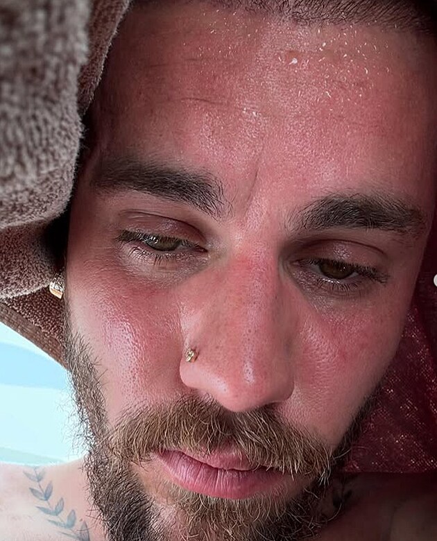 Detox Justina Biebera? Zpvk na stch opt znepokojil sv fanouky