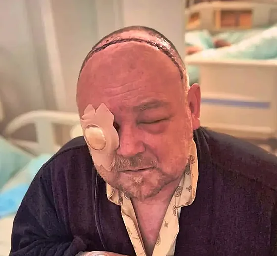 Desítky steh od ucha k uchu. Petr se probudil po operaci bez jednoho oka a s...