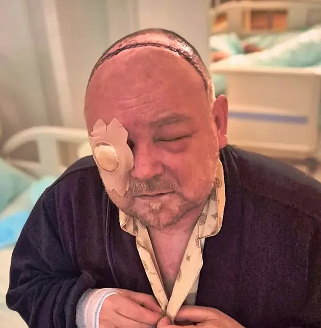 Destky steh od ucha k uchu. Petr se probudil po operaci bez jednoho oka a s...