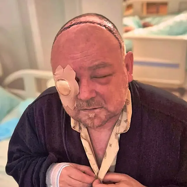 Destky steh od ucha k uchu. Petr se probudil po operaci bez jednoho oka a s nejistou prognzou druhho.