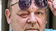 Detail, který íká ve. Petr dnes vidí u jen stíny a obrysy. Nadje na...