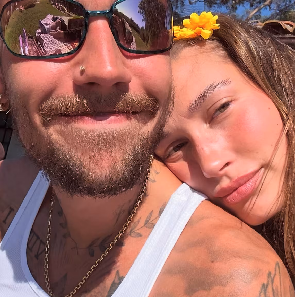 Psychický stav Justina Biebera se výrazně zlepšuje.