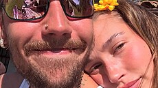 Psychický stav Justina Biebera se výrazn� zlep�uje.