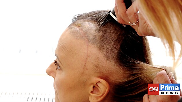 Zblzka je vidt erstv odhalen jizva, kter pipomn tk zkrok, ale tak slu Laky Nrgeov postavit se pravd elem.