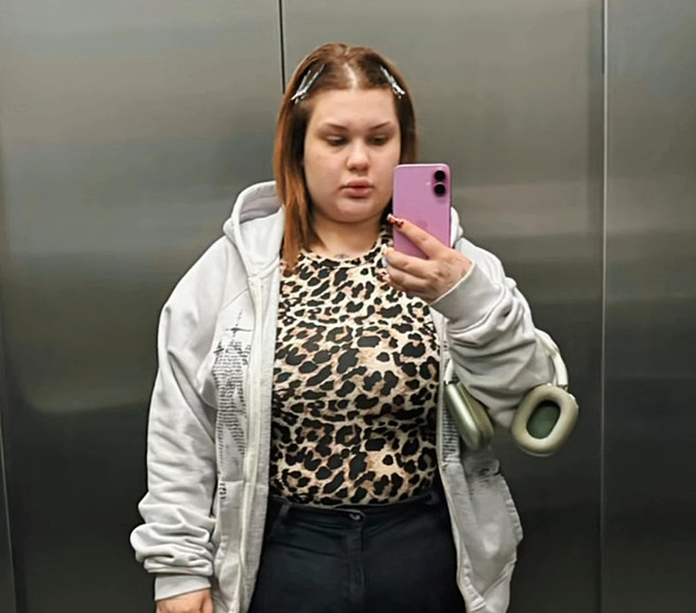 Sugar Denny sdílí pokroky v hubnutí. Za jednu injekci prý platí přes 13 tisíc