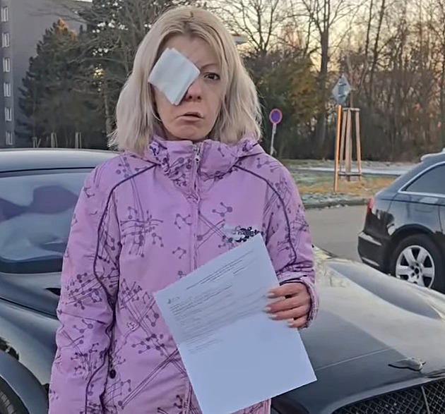 Shopaholic Adel se zbavuje svého koťátka! Škráblo ji do oka, prý mu bude bez ní líp