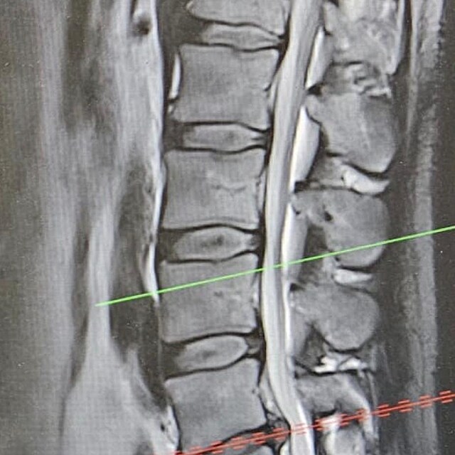 Z�b�ry z rentgenu Filipa Turka