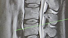 Záb�ry z rentgenu Filipa Turka