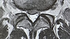 Záb�ry z rentgenu Filipa Turka