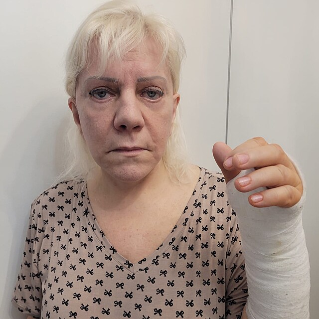 Po n�vratu z nemocnice u� m� ruka pevn� obvaz a zp�va�ka p�sob� vy�erpan�. L�ka�i j� doporu�ili absolutn� klid a z�kaz jak�hokoli nam�h�n�.