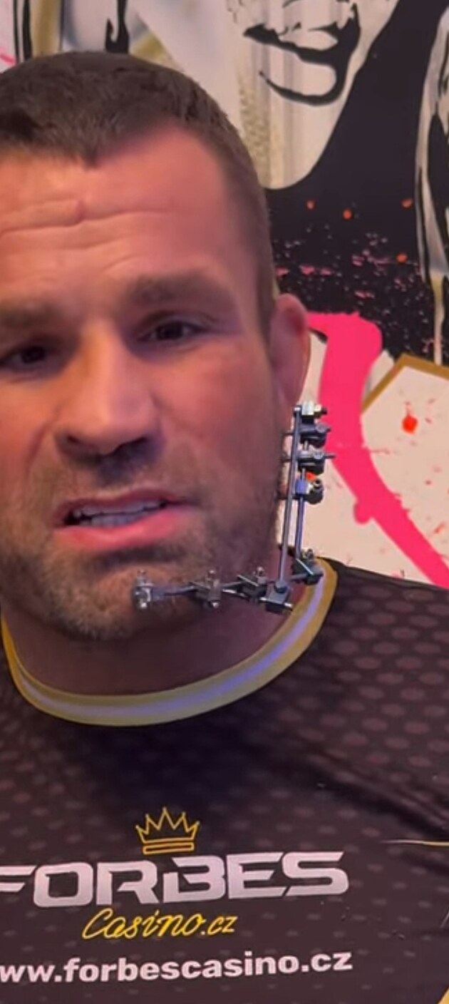 Detail obli�eje. Fixace u �elisti je v z�b�ru nejv�razn�j�� a V�mola p�sob�...