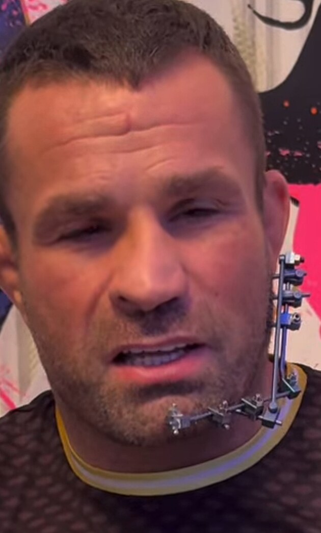 Detail obli�eje. Fixace u �elisti je v z�b�ru nejv�razn�j�� a V�mola p�sob�...