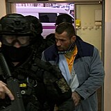 Na lev� stran� obli�eje je vid�t kovov� poopera�n� fixace.