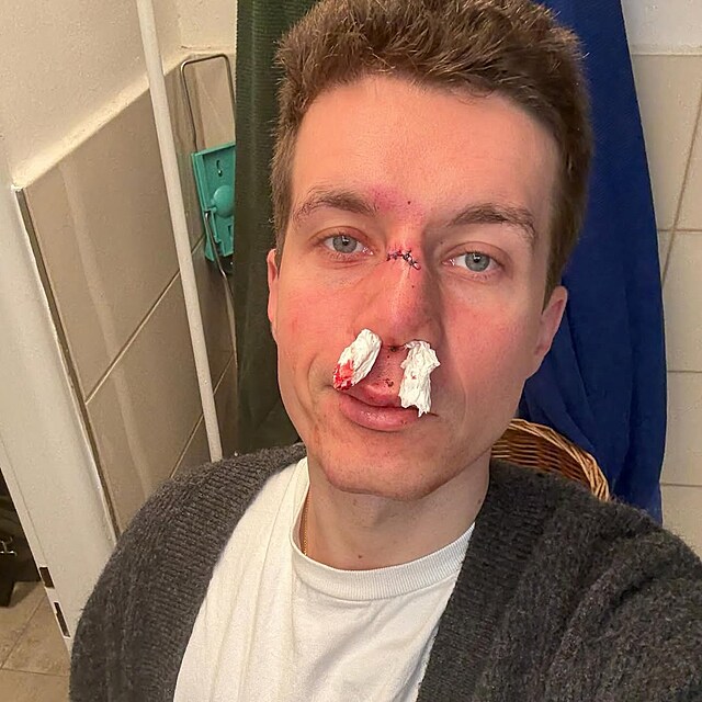 Dan Krej��k vyd�sil fanou�ky fotkou z nemocnice.