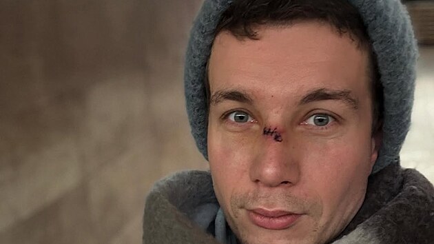 Zran�n� se bude hojit zjevn� dlouho.