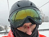 Marian Vojtko m�l úraz na horách.