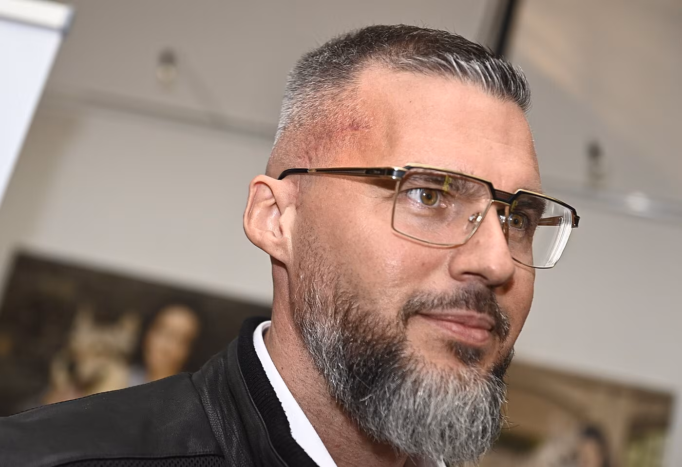 Radek Filipi se poprv� po operaci mozku objevil na ve�ejnosti.