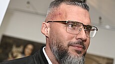 Radek Filipi se poprvé po operaci mozku objevil na ve�ejnosti.