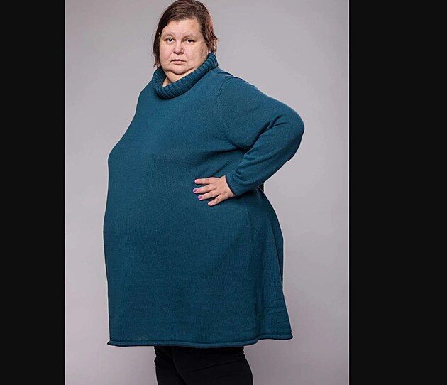 Extr�mn� prom�ny Lud�k a Marie