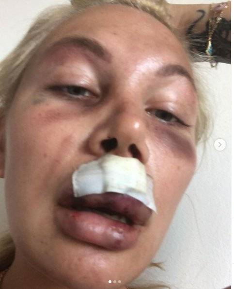 Lia Kees obvinila Richarda Chlada z napaden�. Jen�e pak fotku, kter� podle...