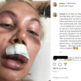 Lia Kees obvinila Richarda Chlada z napaden�. Jen�e pak fotku, kter� podle mnoh�ch vypad� sp�e jako po plastice, smazala.