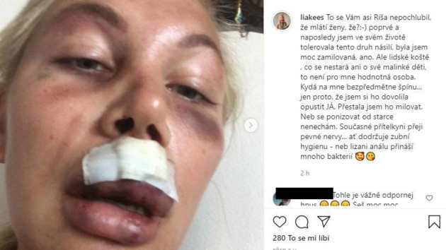 Lia Kees obvinila Richarda Chlada z napadení. Jen�e pak fotku, která podle...