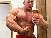 Svein Falzon - kv�li steroid�m �e�í problémy se srdcem