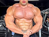 Svein Falzon - kv�li steroid�m �e�í problémy se srdcem