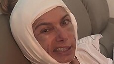 Alice Bendová po záhadném zákroku
