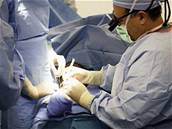 Operaci tenkého steva provádí jen nkolik nemocnic na svt. Ilustraní foto