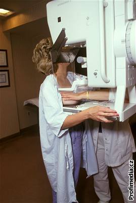 Na mamografické vyetení pilo a dosud jen 40 procent eských en