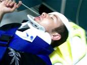 Zranný paparazzi fotograf Alison Silva, kterého svým vozem srazil herec Keanu Reeves