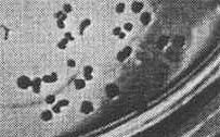 Malá kolonie bakterií z Měsíce