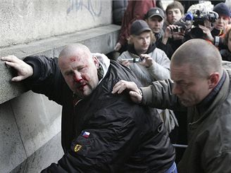 Zbit neonacista po stetu s anarchisty v centru Prahy
