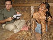 Indonésanovi Dedemu tlo pokrývají puící nádory