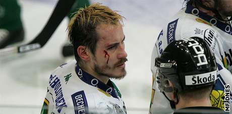 Jan Koál s krvavým zranním zpsobeným hokejkou soupee