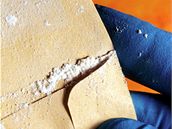 Antrax. Ilustraní foto.