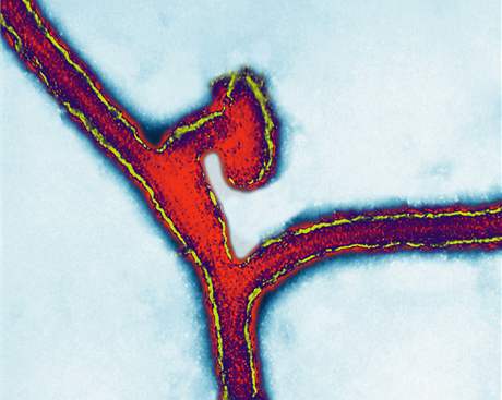 Virus marburg zpsobuje krvácivou horeku podobn jako virus ebola. Úmrtnost nakaených je v obou pípadech 90 procent.