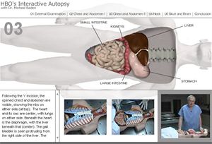 virtuln pitva na HBO: Virtual Autopsy