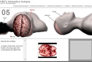 virtuální pitva na HBO: Virtual Autopsy