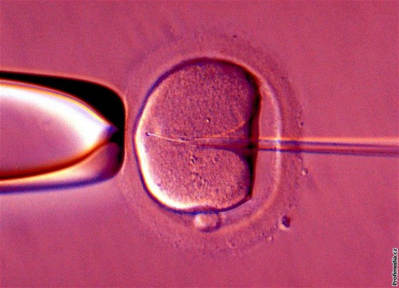 Vdce zajímají zejména schopnosti vítzné spermie. Ilustraní foto