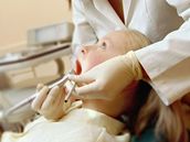 Kvůli dětem bez zubařů obnoví na Karvinsku hromadné školní prohlídky