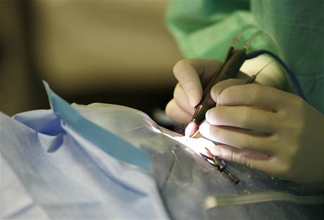 Operace edého zákalu na klinice NeoVize v Brn