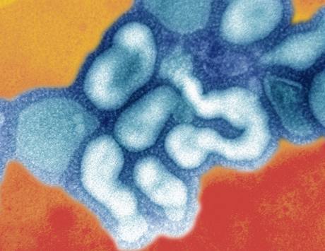 V rakouské laboratoři zkoumají, jak mohl uniknout virus ptačí chřipky do Česka. Kontroly téměř nebyly.