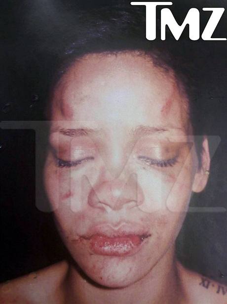 Zmlácená Rihanna - fotografii zveřejnil portál TMZ.com (2009)